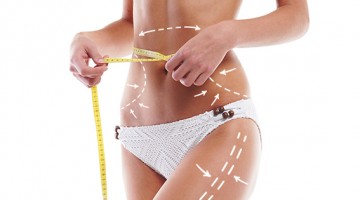 Abdominoplastia