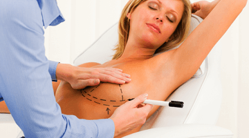Mamoplastia de Aumento